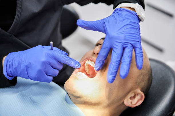 Best Emergency Tooth Extraction in Sutherlin, OR