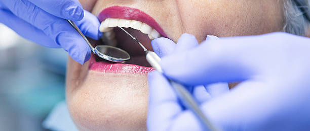 Best Emergency Root Canal Treatment in Sutherlin, OR